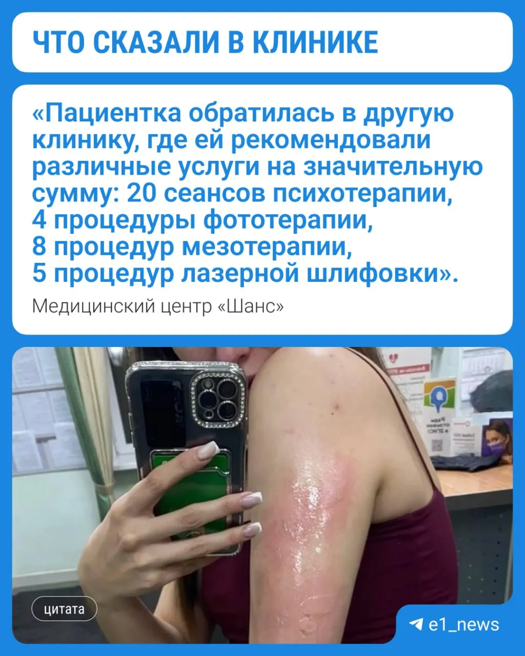 Женщина почувствовала себя плохо и легла на кушетку; по версии медицинского центра, она обожглась о батарею. Медики утверждают, что сразу обработали рану и предлагали помощь, заключение судмедэкспертизы пациентка пока не предоставила.