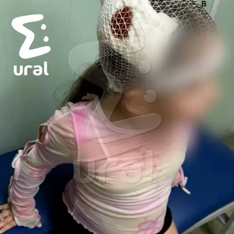 В квартире в Екатеринбурге пятилетняя девочка оказалась придавлена большим шкафом. В больнице у ребёнка диагностировали переломы позвоночника в нескольких местах.