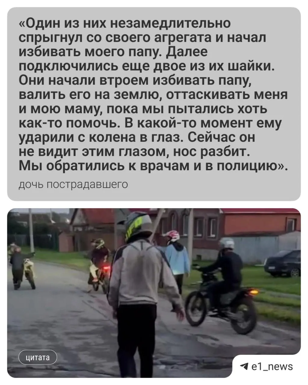 В селе Большебрусянском группа подростков на питбайках напала на 52-летнего Виктора после того, как он попросил их не шуметь из‑за спящей трехмесячной внучки. Мужчина получил серьёзные травмы лица, родственники жалуются на отсутствие реагирования полиции.