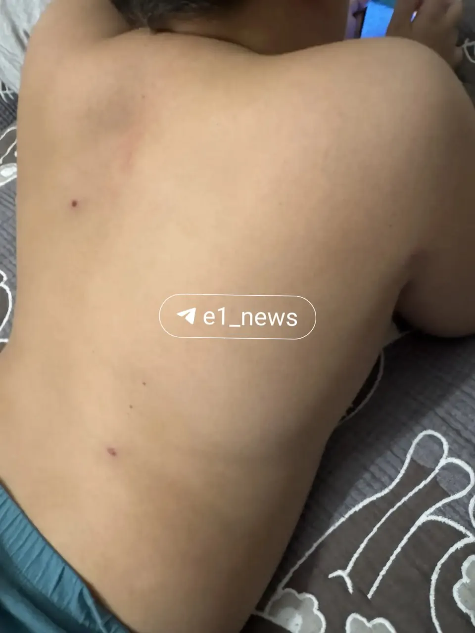 Мальчик получил четыре ранения. Мать заявила в полицию, ребёнка направили на судмедэкспертизу.