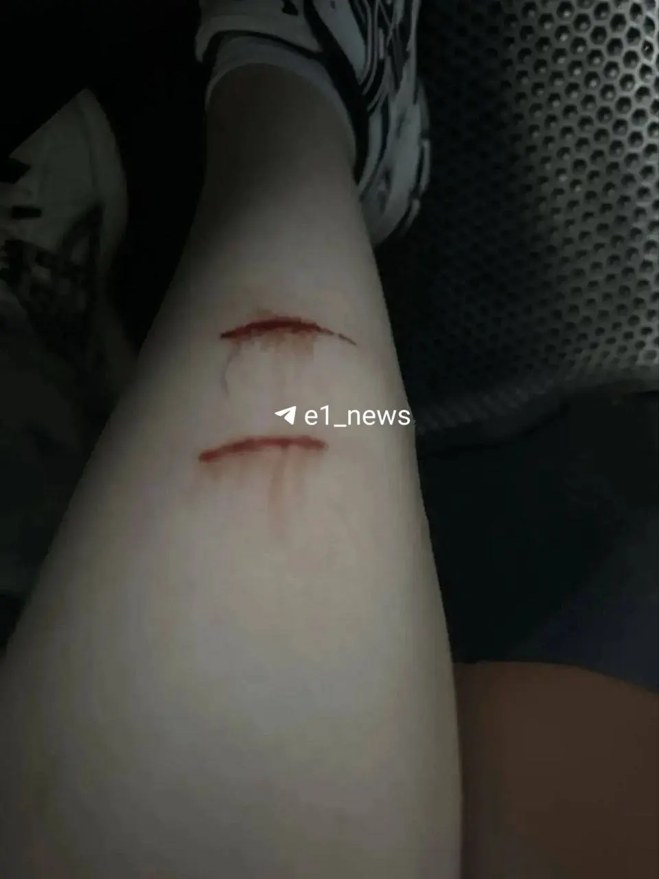 16-летняя девушка пострадала после нападения стаи бездомных собак возле улицы Европейской. Пострадавшая госпитализирована; ситуацию контролируют местные службы.