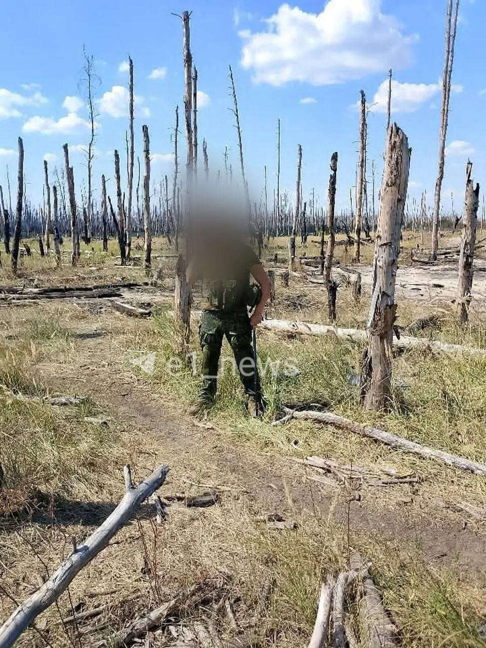 Военнослужащий Денис вернулся в отпуск из зоны спецоперации, попал в тяжёлое ДТП и сейчас борется за освобождение от службы, находясь в госпитале.
